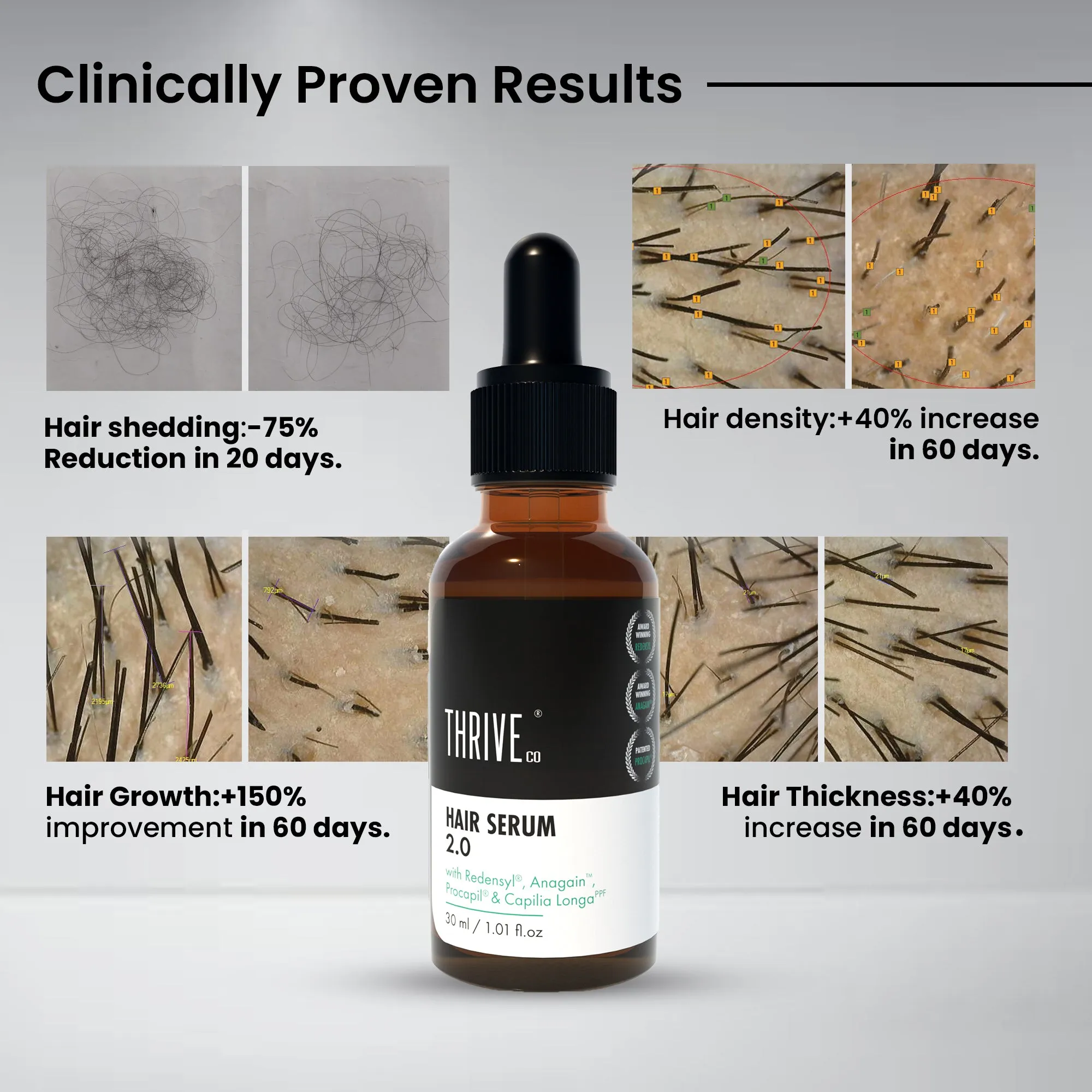 ThriveCo Restorative Hair Growth Kit: Hair Growth Serum 2.0 & Hair Vitalizing Shampoo